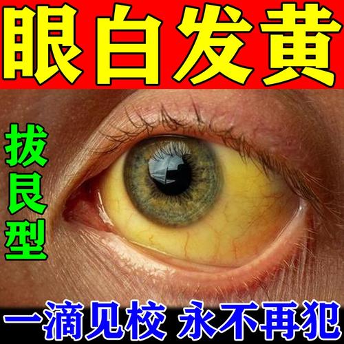 眼白清澈去黄滴眼液除眼球黄斑眼白发黄浑浊干涩模糊红血丝眼药水