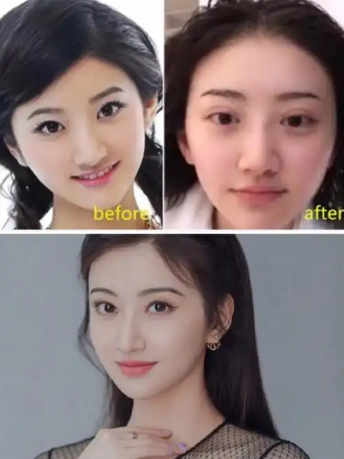 欧式大平行变窄,景甜颜值高峰期