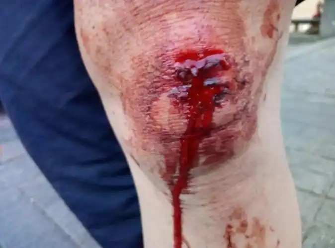 哈尔滨男子打车被拖行百米远,多处受伤血流不止 | 伤者悬赏1万寻肇事