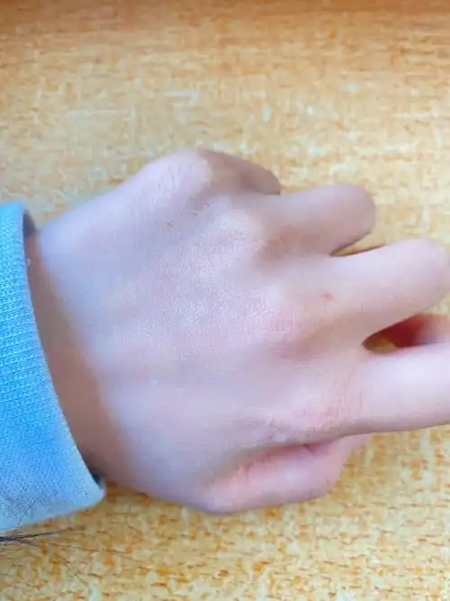 最近很火的朱砂痣长什么样? - 知乎