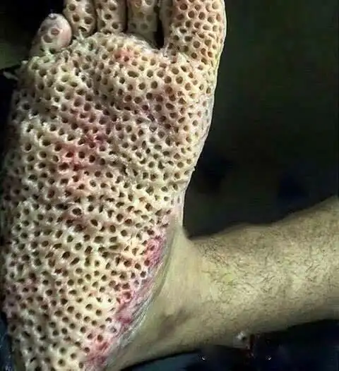 有哪些恶心的图片? - 知乎