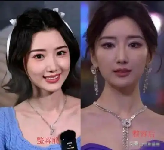 同样顶着整容脸,毛晓彤跟金晨对比,差距一目了然