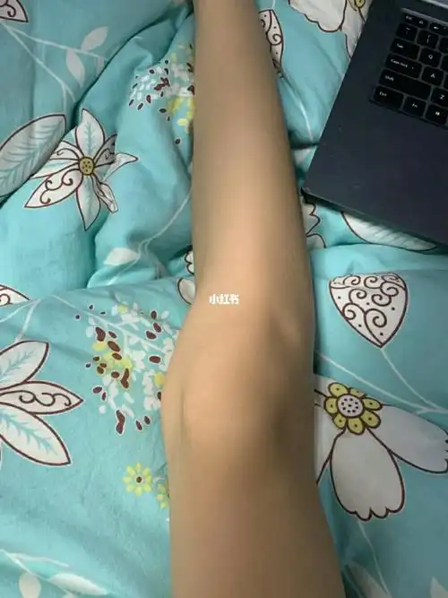 滑膜炎膝盖积液怎么办 我是一年前正常行走时感觉左膝突然疼痛,没有