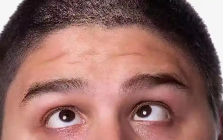 面相分享: 额头窄小:主出生贫寒,早年辛苦,白手起家,出社会 - 抖音