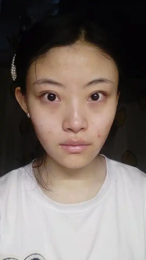 这是素颜正脸 皮肤不好