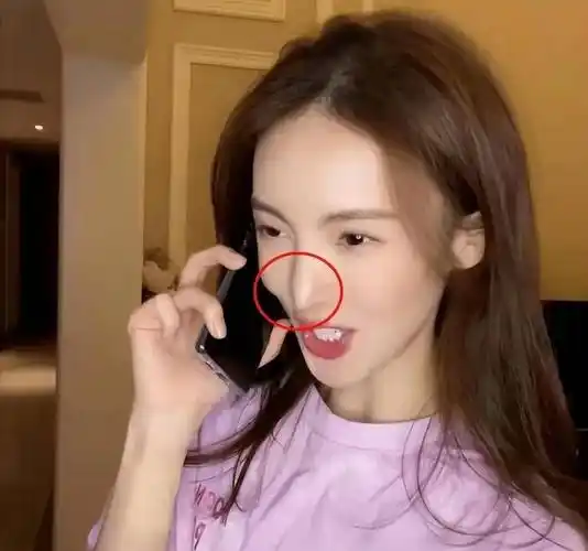 金晨是否整容,看看照片前后对比就知道了