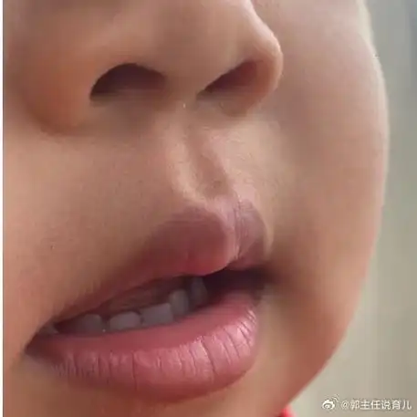 儿童健康守护者计划##国医的精诚力量##脾胃虚弱