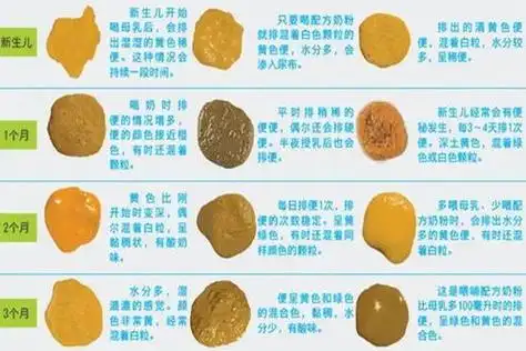 宝宝便便图解:3种算正常,6种太异常,另外这几种要警惕_知识 - 名片网