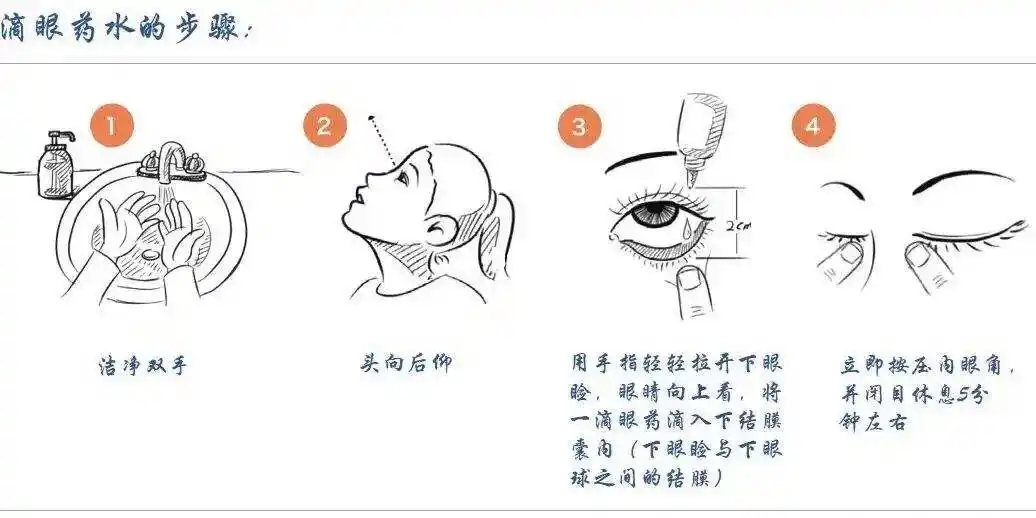滴眼药水原来还有这么多讲究