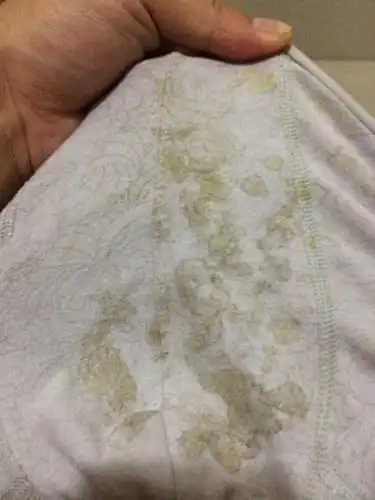 6岁小女孩得了妇科病!许多宝妈都忽视了