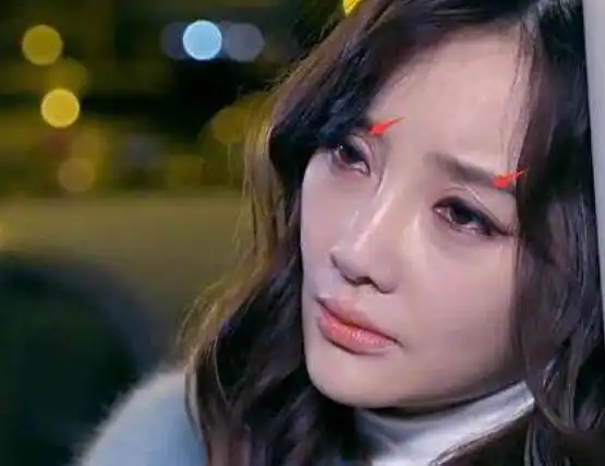 景甜的悲伤蛙双眼皮消失之后颜值高了,割坏了的双眼皮真的会毁脸