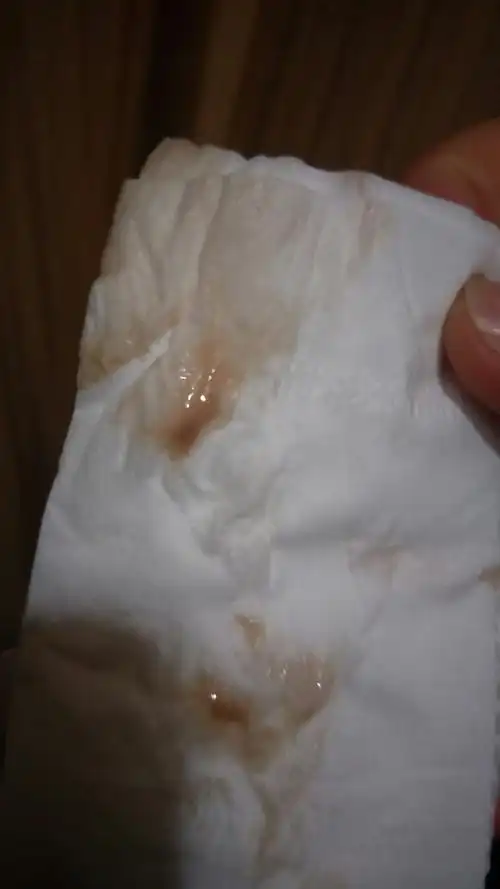 月经迟来二是气候方面变化也会引起身体不适造成迟来三是可能怀孕了