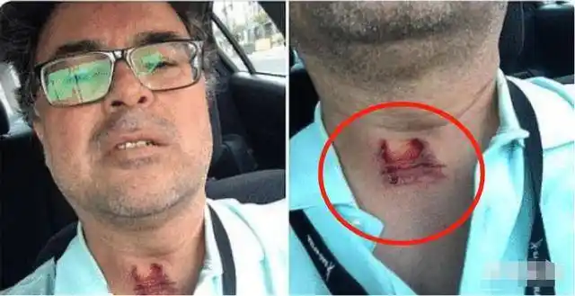 橡胶子弹威力有多大?美国抗议者纷纷晒照片诉苦,伤口惨不忍睹