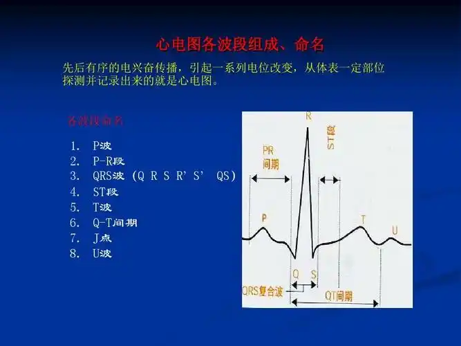 各种心电图表现ppt