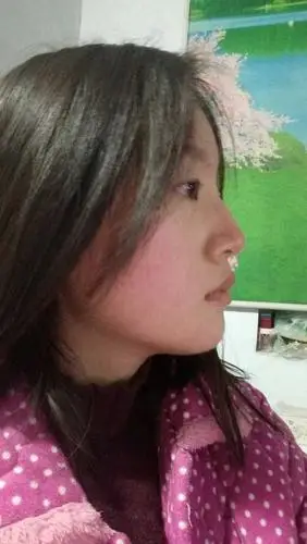 侧脸丑到不知道怎么整?