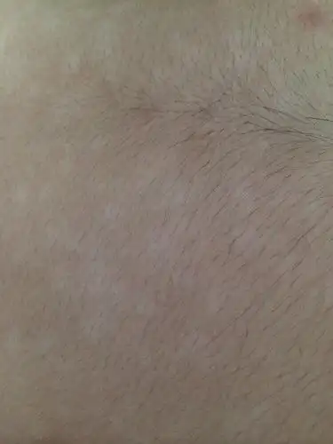 身上这样的花斑是什么皮肤病啊 不痛不痒 喝酒后特别明显