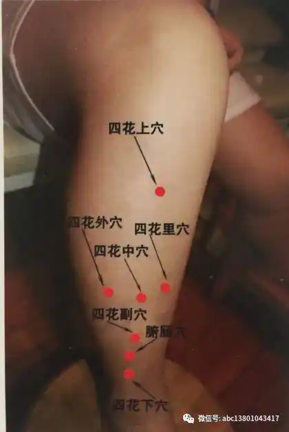 董氏奇穴刺血治疗疑难杂症的万能穴位 - 好网角收藏夹