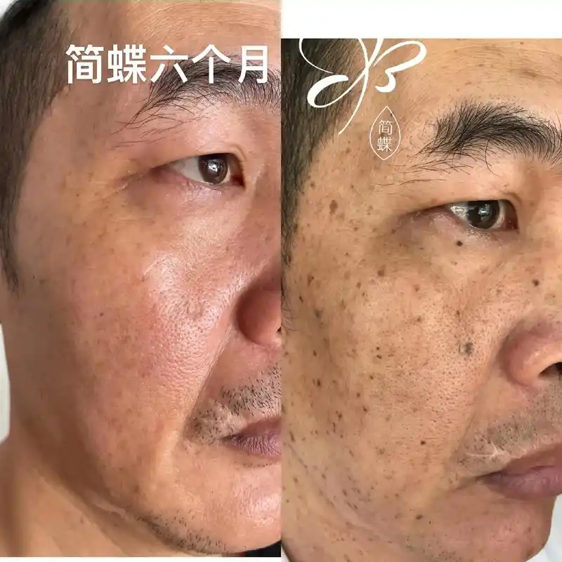 03"简蝶"养颜露功效:解决皮肤暗黄暗沉,粗糙,痘痘,粉刺, - 抖音
