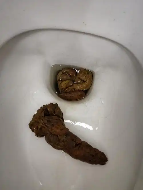 大家觉着自己拉过的形状最牛逼的屎是什么样的