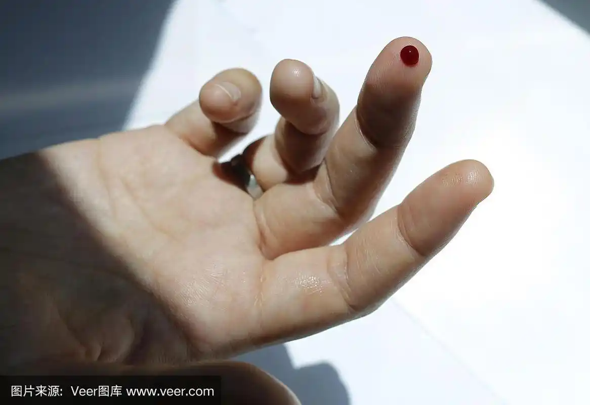 手指上的血