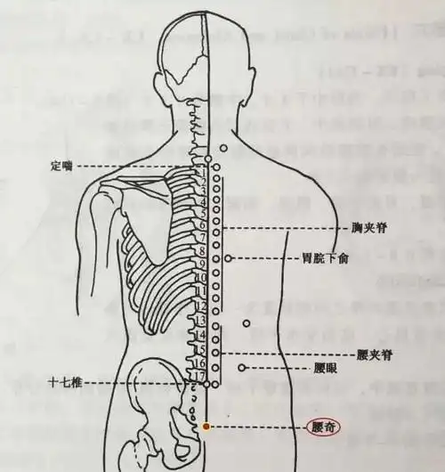 腰奇穴——治腰脊强痛,便秘,坐骨神经痛