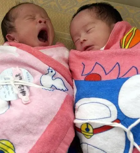 怀上双胞胎到底是幸运还是不幸