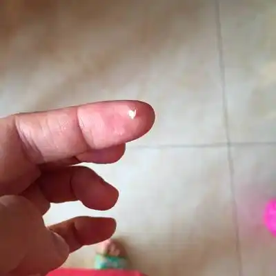 专家回答               宝宝14个月,23日开始发现宝宝尿尿的口变小