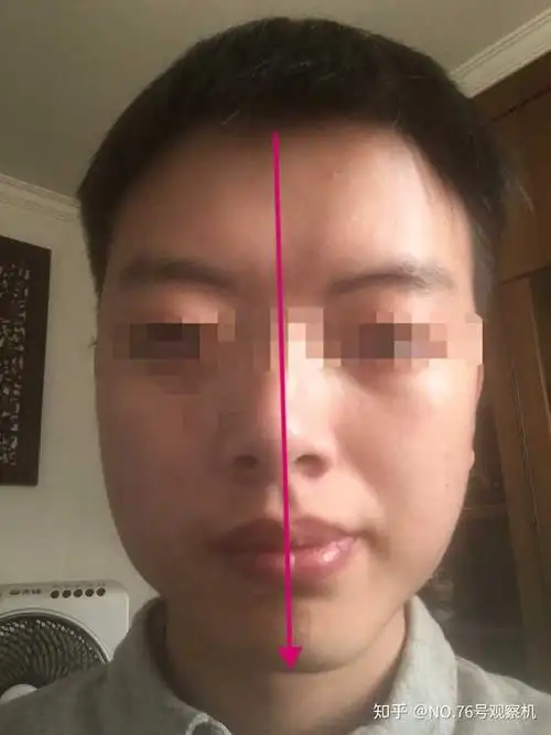 突然发现脸特别歪怎么办?