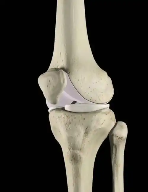 换膝盖骨的视频,好可拍.