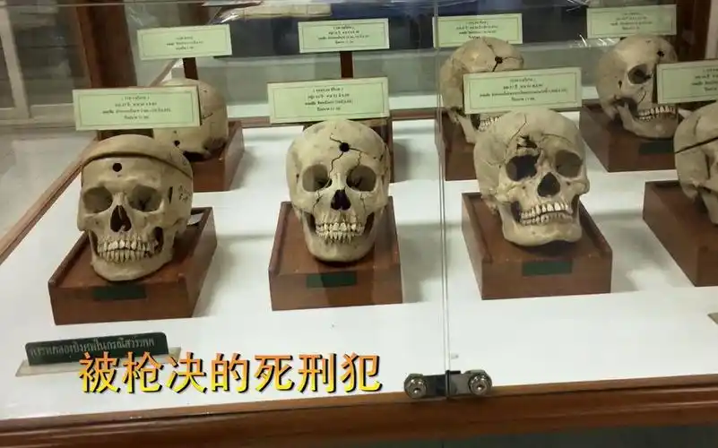 医院藏尸!被抢决的死刑犯的头颅,脑袋真的是开花了!