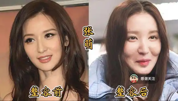 18位女明星整容前后对比邵音音面目全非杨颖堪称整容模板