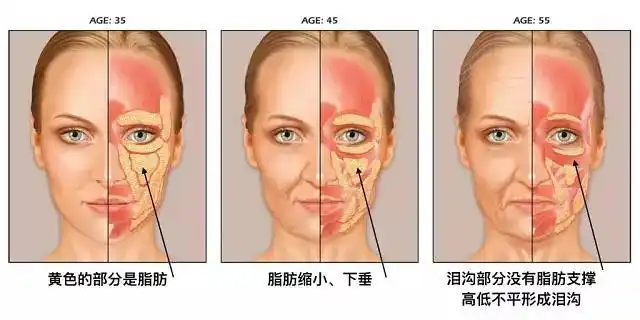 让我们看一组面部衰老过程示意图