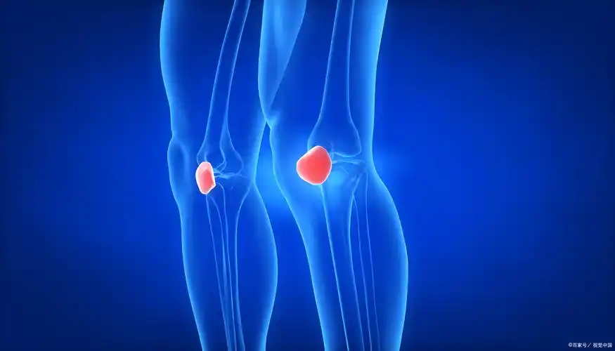 全民运动之"保护你的膝盖"