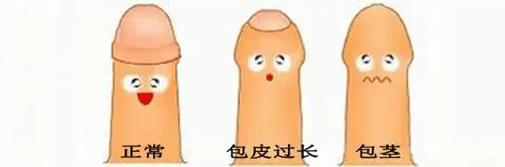 其实男人的丁丁是慢慢发育长大的,出生时小鸡鸡都是天生的包茎,龟头都