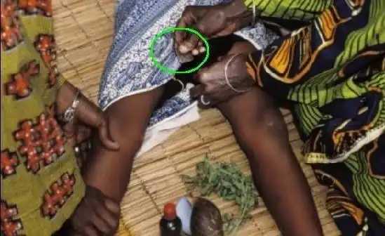 揭秘非洲少女阴蒂割礼全过程(4)