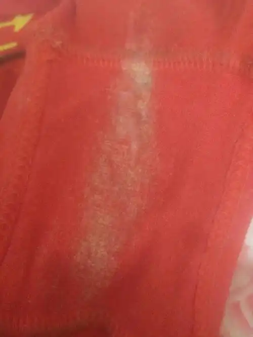 孕晚期内裤上有这种白带正常吗