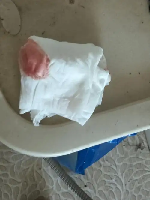 月经推迟了3天今天早上上厕所突然发现有血垫了卫生巾又没有了这