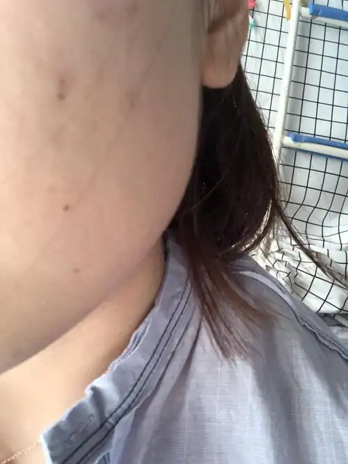 女生左边脸靠下三颗痣连成一条线表示什么?