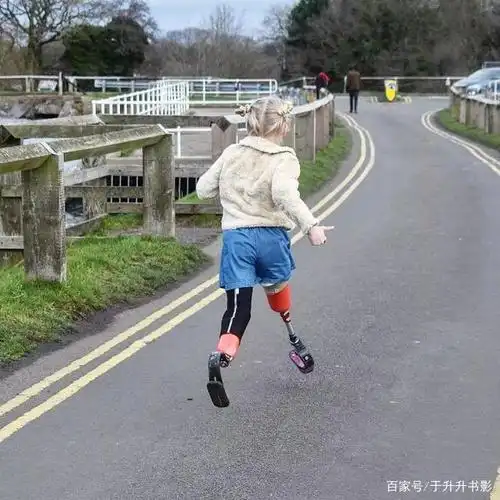 黛西用她的实际行动,向世界证明着:"命运以痛吻我,我却报之以歌.