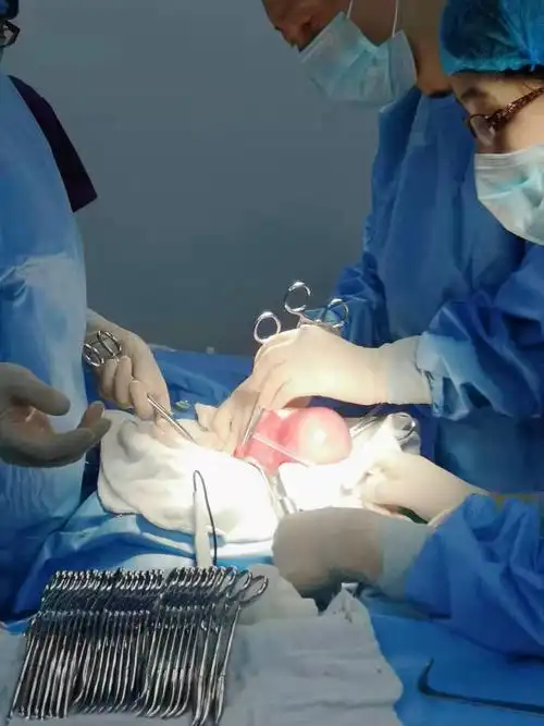 手术中切除的子宫