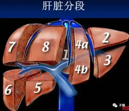 孙英姿老师"肝胆疾病的超声诊断"学习笔记 (2017山东省第三届超声引导