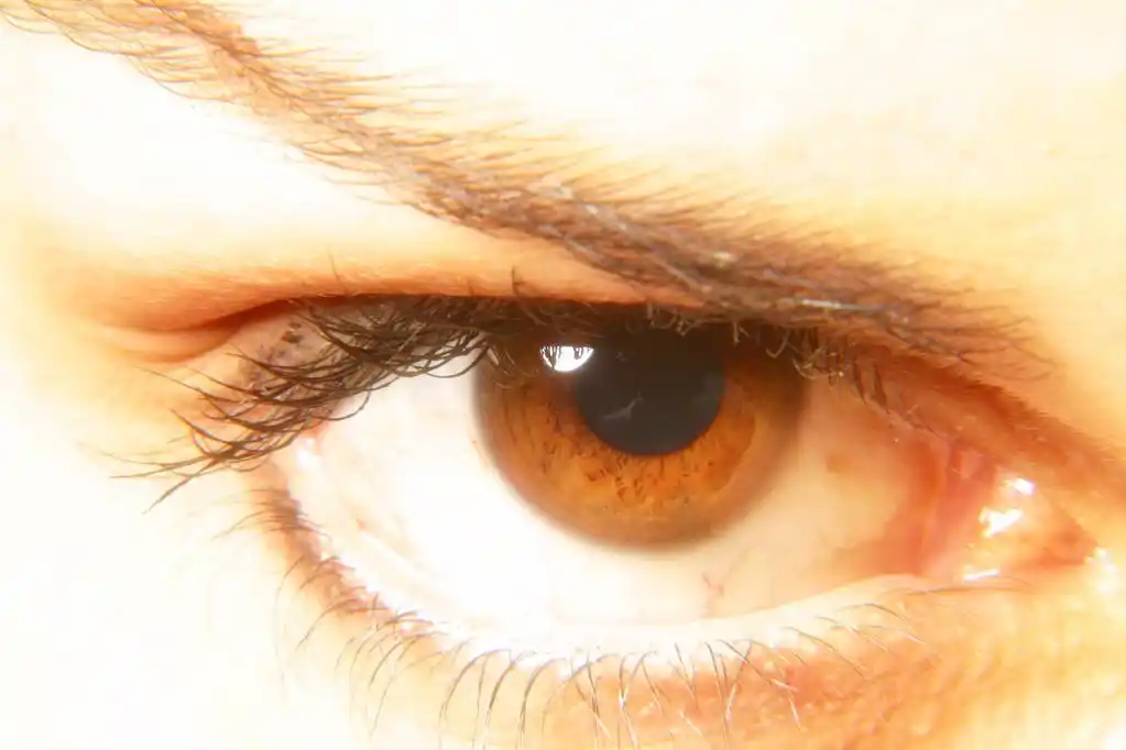 人类的黑眼睛,宏形象的人类的黑眼圈