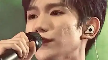 王源镜头下真实颜值曝光,脸部痤疮严重被嘲烂脸?网友:别吸烟了