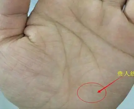 手相贵人线有哪些含义_生辰八字算命网