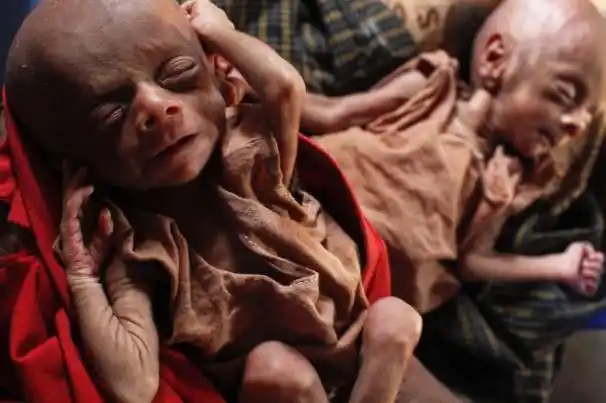 shocking images of the worlds most forsaken peo