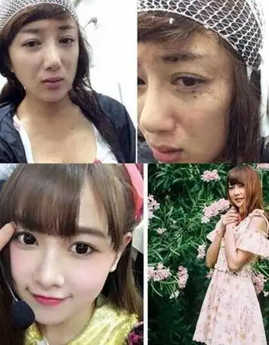 【图】snh48成员唐安琪首度发声 曝光烧伤全过程疑是有内幕