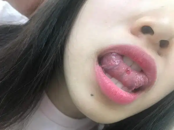 太难受了 吃一点点辣就突然长出来 答题抽奖 首次认真答题后 即可