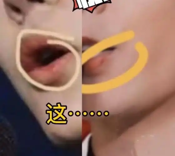 肖战王一博嘴巴疑上火两人同台领奖却被嘴巴抢了镜