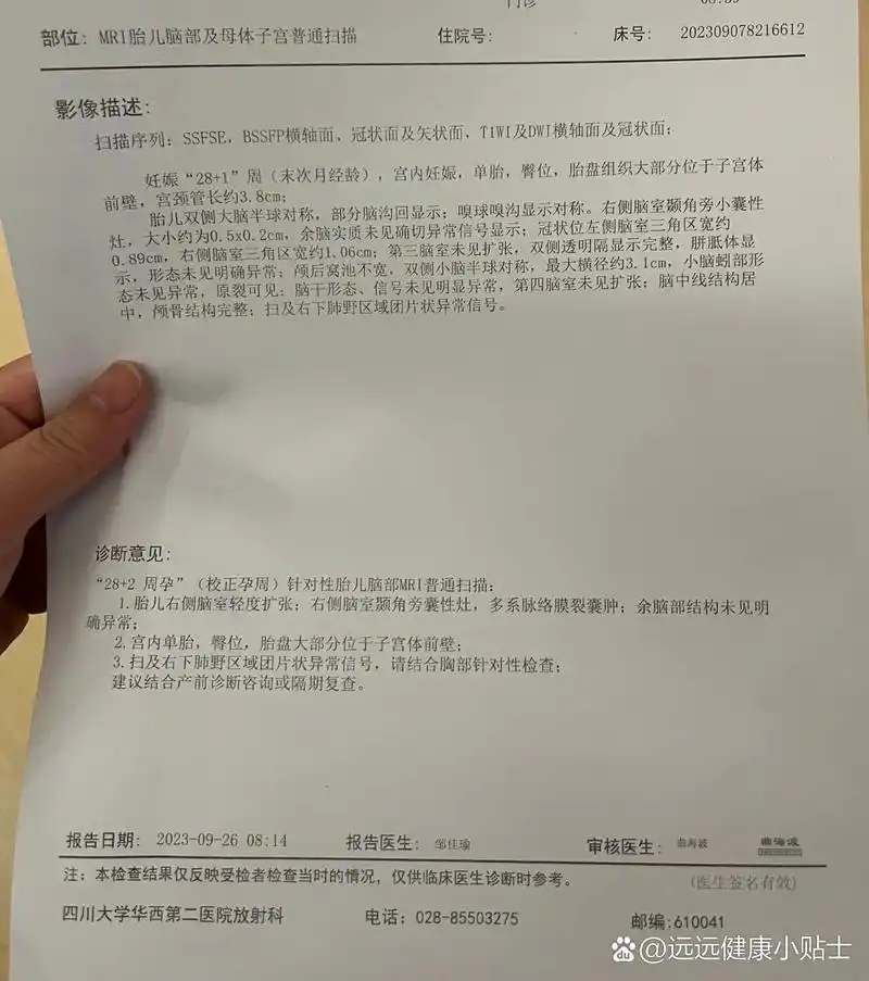 右侧脑室增宽,右侧脉络膜裂囊肿.