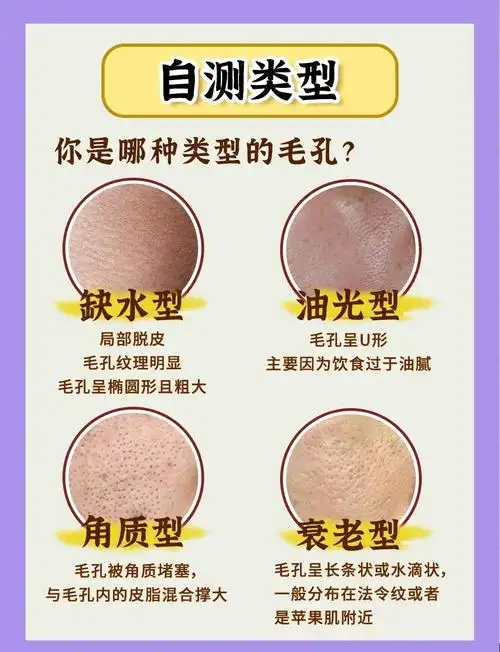毛孔问题?4种类型对症下药!